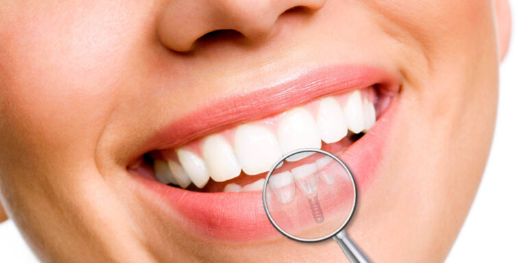 Nuevo Convenio: Clínica Dental Odonto Vespucio