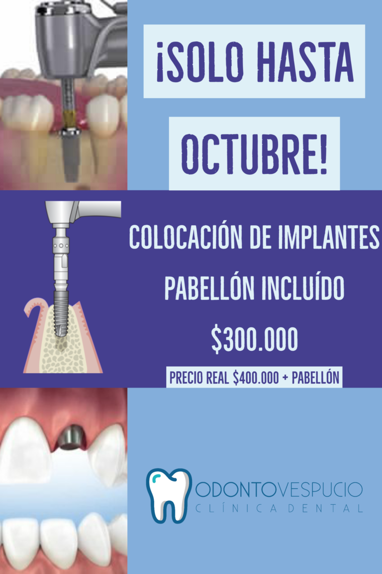 Nueva promoción de Clínica Dental Odonto Vespucio